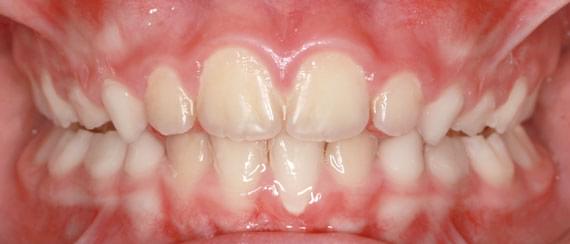 healthy teeth 7 years